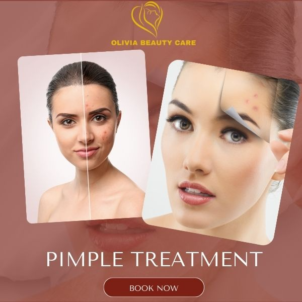 Pimple Treatment