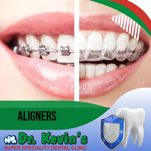Aligners