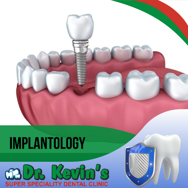 Implantology
