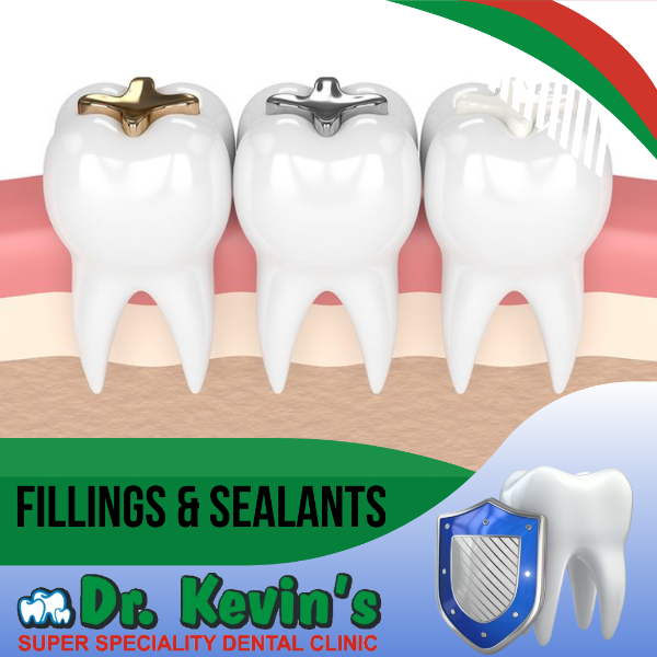 Fillings and sealants