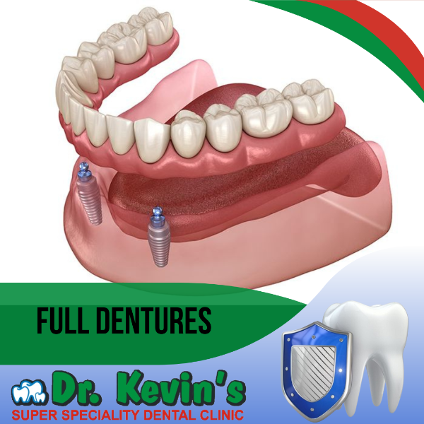 Full Dentures