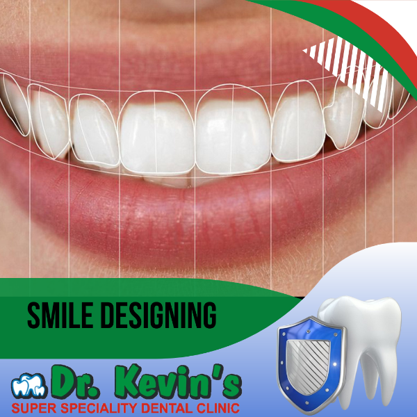 Smile Designing