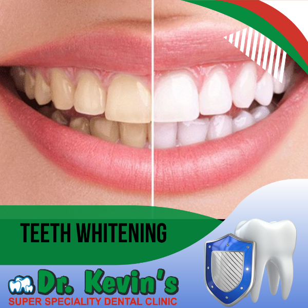 Teeth Whitening