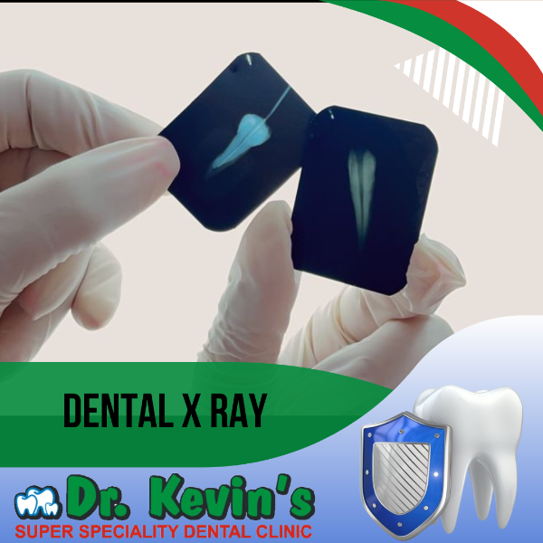 Dental X Ray