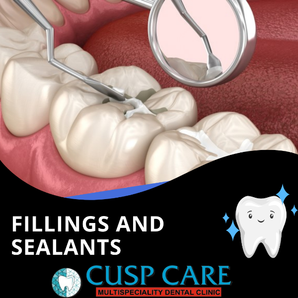 Fillings and sealants