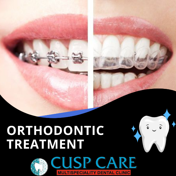 Orthodontic treatment- steel & ceramic braces,clear aligner