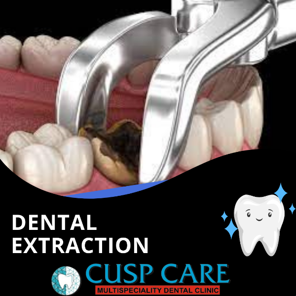 Dental extraction