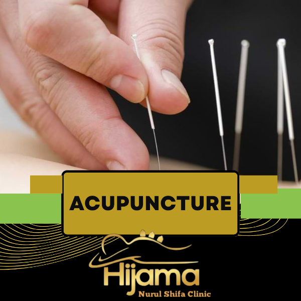 Acupuncture Therapy