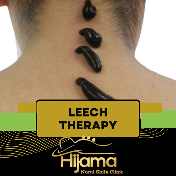 Leech Therapy