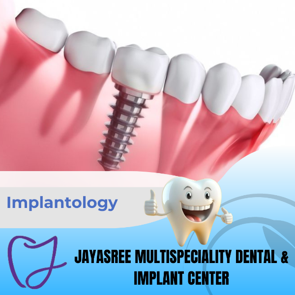 Implantology
