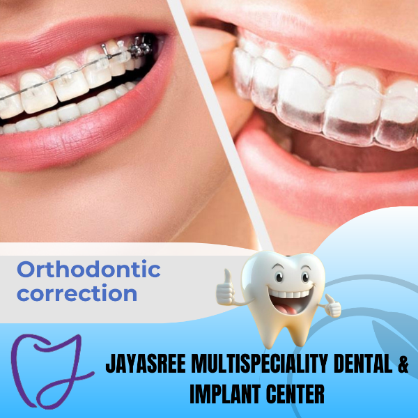 Orthodontic correction