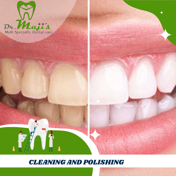 Cleaning and Polishing