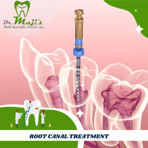 ROOT CANAL TREATMENT