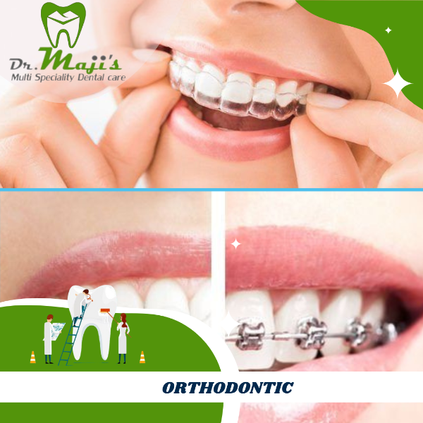 ORTHODONTIC TREATMENT - STEEL AND CERAMIC BRACES , CLEAR ALIGNER