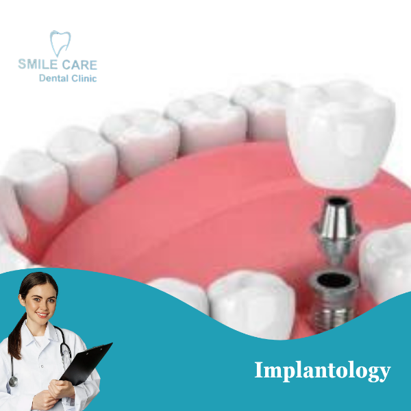 Implantology