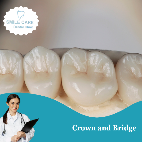Crown and Bridge