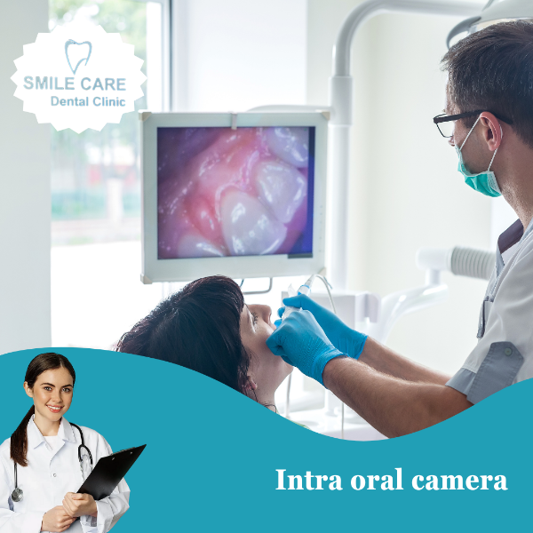 Intra Oral Camera