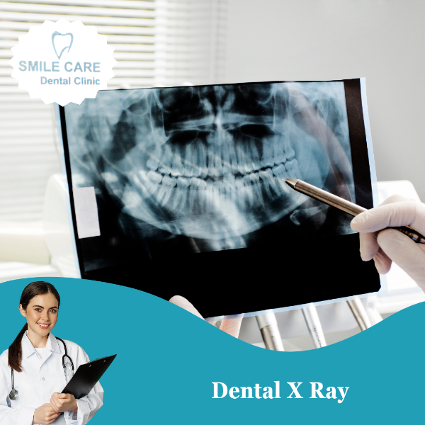Dental X Ray