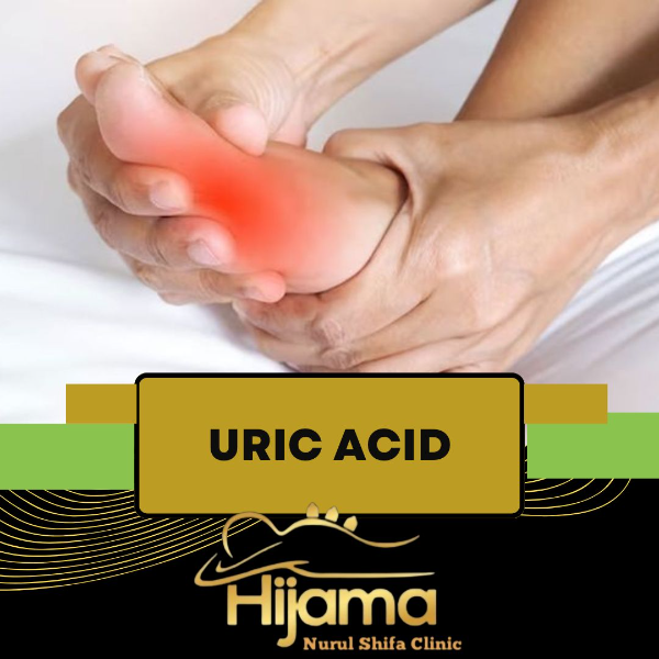 Uric Acid