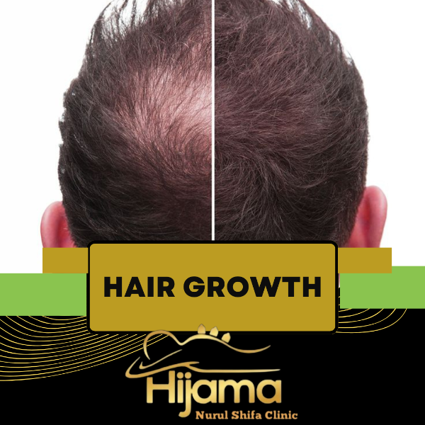 Hair Growth Treatment