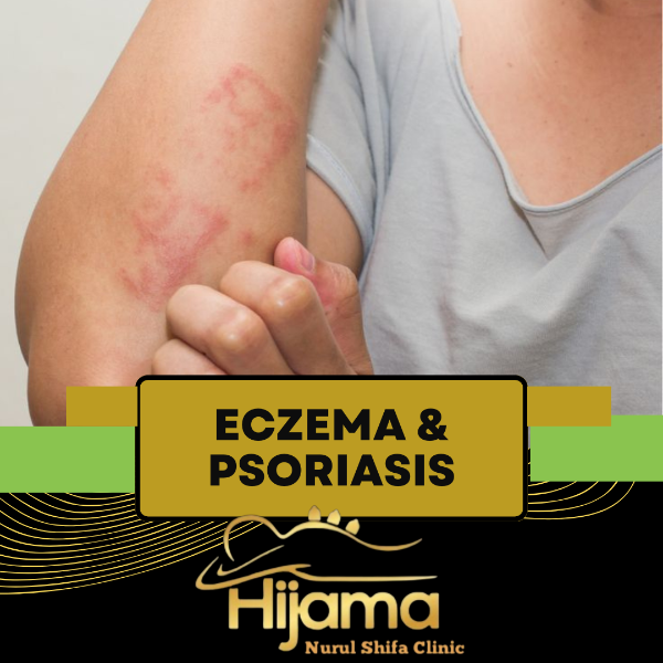 Eczema & Psoriasis