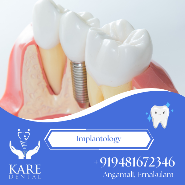 Implantology