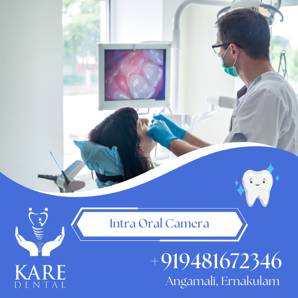Intra Oral Camera