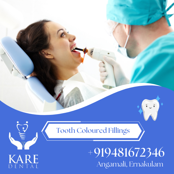 Tooth Coloured Filling