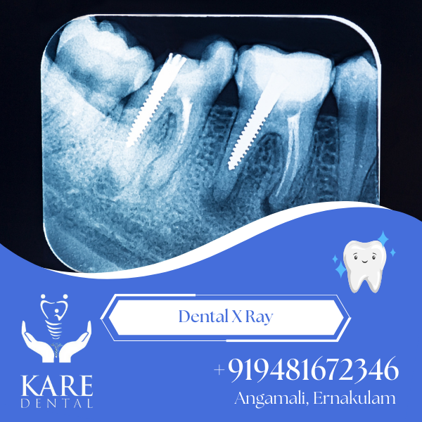 Dental X Ray