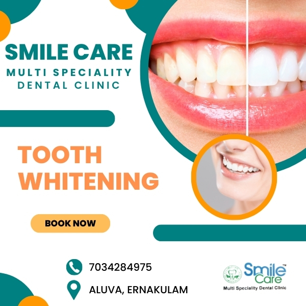 TOOTH WHITENING