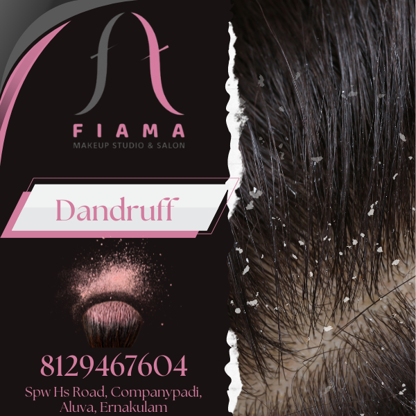 Dandruff Treatment