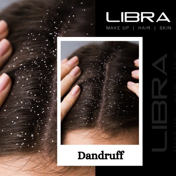 Dandruff Treatment