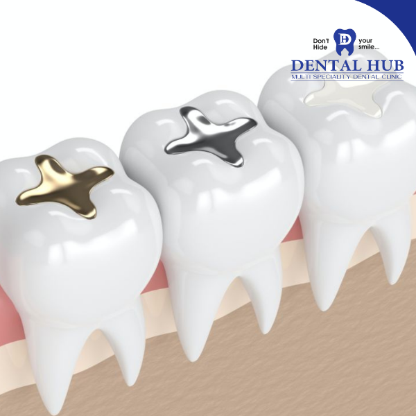 FILLINGS AND SEALANTS