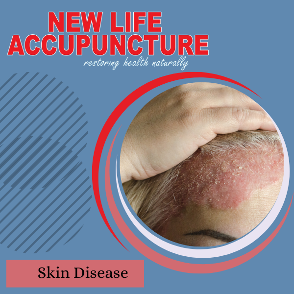 SKIN DISEASE