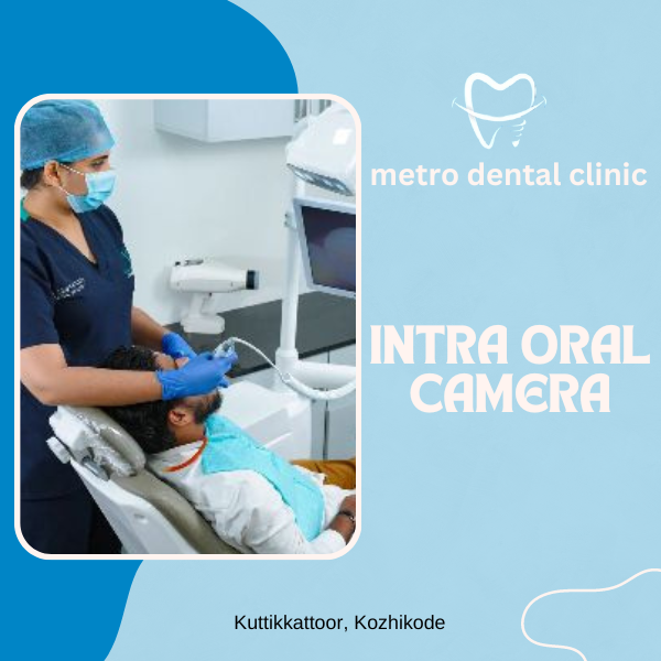intra oral camera