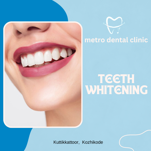 teeth whitening