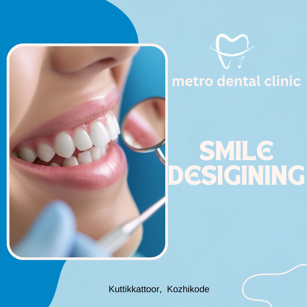 smile desigining