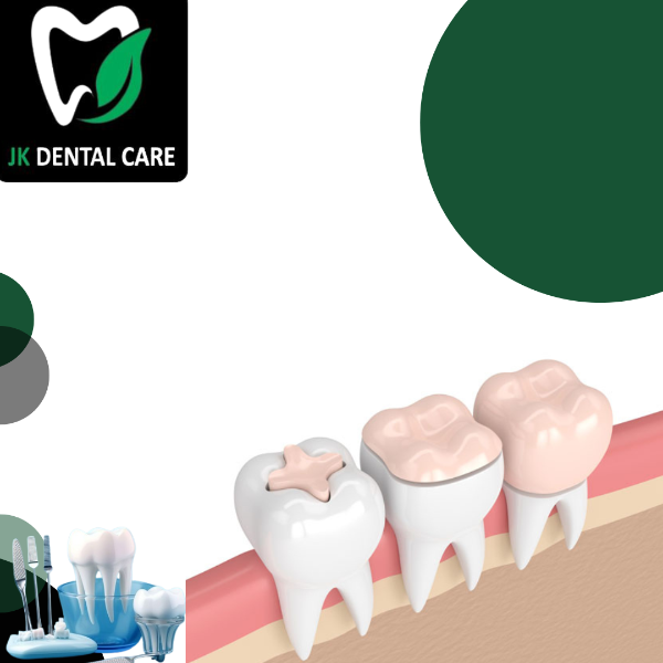 Teeth Restoration