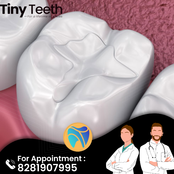 Fillings and sealants