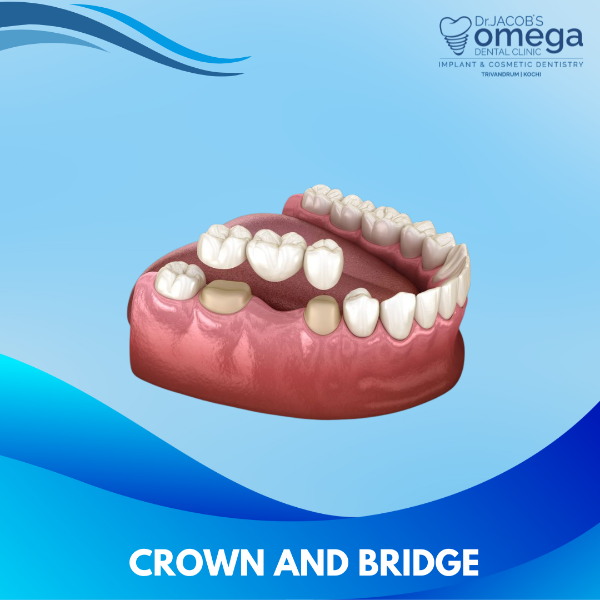 CROWN AND RIDGE