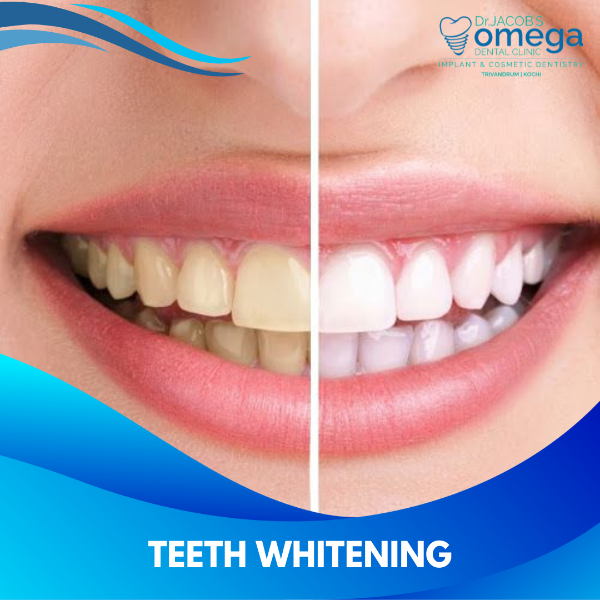 TEETH WHITENING