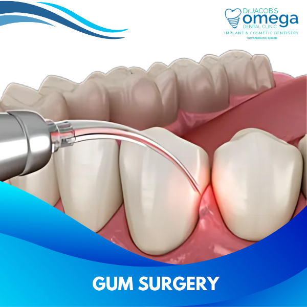 GUM SURGERY