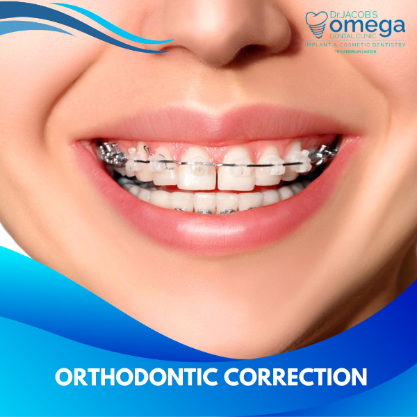 ORTHODONTIC CORRECTION