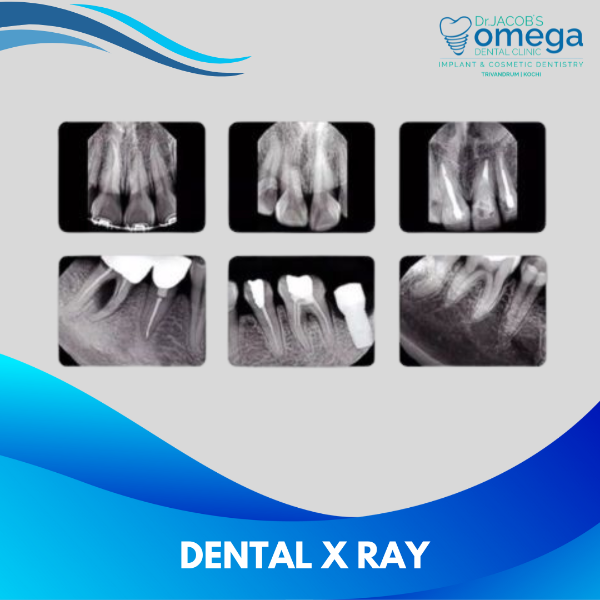 DENTAL X RAY
