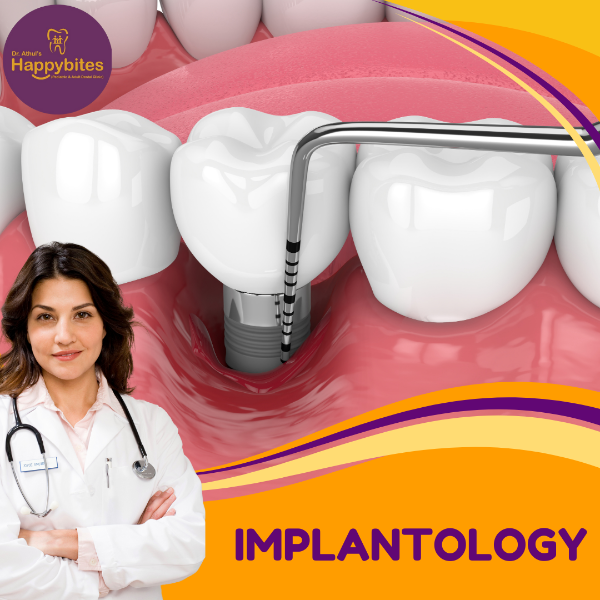 IMPLANTOLOGY