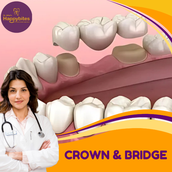 CROWN AND BRIDGE