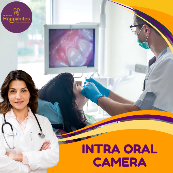 INTRA ORAL CAMERA