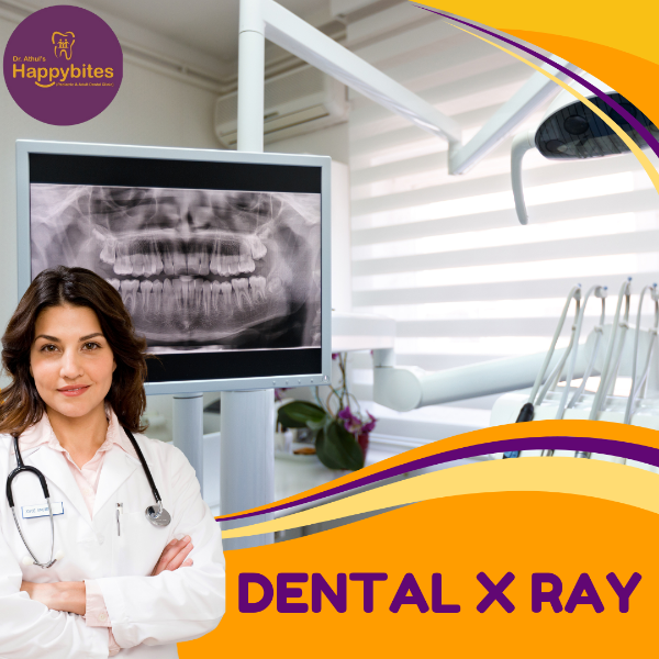 DENTAL X RAY