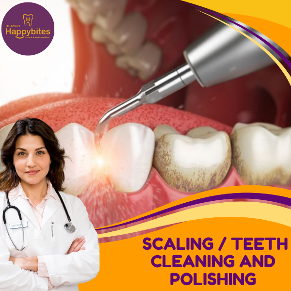 SCALING/TEETH CLEANING AND POLISHING