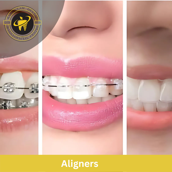 Aligners